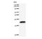 Transcription Factor AP-2 Alpha antibody, LS-C342377, Lifespan Biosciences, Western Blot image 