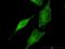 Hsp110 antibody, H00023176-M08, Novus Biologicals, Immunofluorescence image 