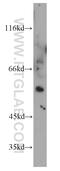 Sestrin-1 antibody, 55010-1-AP, Proteintech Group, Western Blot image 