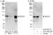 BTB Domain And CNC Homolog 1 antibody, A303-057A, Bethyl Labs, Immunoprecipitation image 