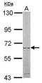 5'-Nucleotidase, Cytosolic II antibody, GTX105719, GeneTex, Western Blot image 