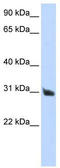 Ribonuclease A Family Member 9 (Inactive) antibody, TA346522, Origene, Western Blot image 