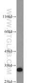 Syndecan Binding Protein antibody, 22399-1-AP, Proteintech Group, Western Blot image 