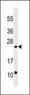Dual specificity protein phosphatase 13 antibody, PA5-72086, Invitrogen Antibodies, Western Blot image 