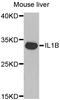 Interleukin 1 Beta antibody, TA326933, Origene, Western Blot image 