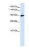 DNA repair and recombination protein RAD54B antibody, NBP1-58238, Novus Biologicals, Western Blot image 