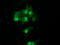 Ubiquitin-conjugating enzyme E2 S antibody, LS-C174207, Lifespan Biosciences, Immunofluorescence image 