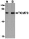 Translocase Of Outer Mitochondrial Membrane 70 antibody, orb75117, Biorbyt, Western Blot image 