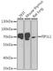 Pre-mRNA 3 -end-processing factor FIP1 antibody, A02452, Boster Biological Technology, Western Blot image 