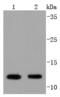 Vesicle Associated Membrane Protein 8 antibody, A02338-1, Boster Biological Technology, Western Blot image 