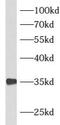Cyclic AMP-dependent transcription factor ATF-1 antibody, FNab00659, FineTest, Western Blot image 