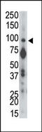 Serine/threonine-protein phosphatase 2A activator antibody, 63-460, ProSci, Western Blot image 