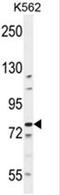 BAF Chromatin Remodeling Complex Subunit BCL11B antibody, AP50356PU-N, Origene, Western Blot image 