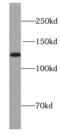 Ubinuclein-1 antibody, FNab09202, FineTest, Western Blot image 