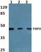 Thrombopoietin antibody, GTX66769, GeneTex, Western Blot image 