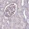 EH Domain Containing 2 antibody, PA5-61497, Invitrogen Antibodies, Immunohistochemistry frozen image 