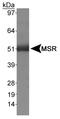 CD204 antibody, NB400-159, Novus Biologicals, Western Blot image 