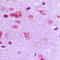 FER Tyrosine Kinase antibody, LS-C352193, Lifespan Biosciences, Immunohistochemistry paraffin image 