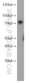 Mitochondrial tRNA-specific 2-thiouridylase 1 antibody, 14970-1-AP, Proteintech Group, Western Blot image 