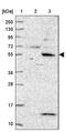 Kelch Repeat And BTB Domain Containing 11 antibody, PA5-62334, Invitrogen Antibodies, Western Blot image 