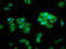 Charged Multivesicular Body Protein 5 antibody, LS-C372176, Lifespan Biosciences, Immunofluorescence image 