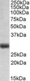 Fibroblast Growth Factor 5 antibody, TA309534, Origene, Western Blot image 