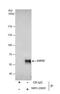 Ubiquitin carboxyl-terminal hydrolase 22 antibody, NBP2-20829, Novus Biologicals, Immunoprecipitation image 