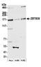 Zinc Finger And BTB Domain Containing 38 antibody, A305-894A-M, Bethyl Labs, Western Blot image 