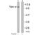 Vav Guanine Nucleotide Exchange Factor 1 antibody, AP02686PU-S, Origene, Western Blot image 