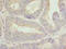 Calmegin antibody, A62290-100, Epigentek, Immunohistochemistry paraffin image 