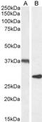 Uncoupling Protein 2 antibody, NB100-59742, Novus Biologicals, Western Blot image 