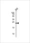 R-spondin-2 antibody, LS-C162783, Lifespan Biosciences, Western Blot image 