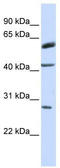 RING finger protein 170 antibody, TA330477, Origene, Western Blot image 
