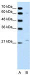 Regulator of G-protein signaling 4 antibody, TA329133, Origene, Western Blot image 