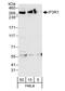 Inositol 1,4,5-Trisphosphate Receptor Type 1 antibody, A302-158A, Bethyl Labs, Western Blot image 