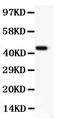 CD11b antibody, PB9140, Boster Biological Technology, Western Blot image 