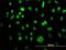 Minichromosome Maintenance Complex Component 3 antibody, H00004172-M01, Novus Biologicals, Immunocytochemistry image 