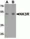 Tachykinin Receptor 3 antibody, NBP2-82076, Novus Biologicals, Western Blot image 