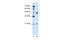 Ubiquitin Conjugating Enzyme E2 E2 antibody, 29-870, ProSci, Immunohistochemistry frozen image 