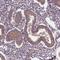 FERM And PDZ Domain Containing 1 antibody, PA5-60166, Invitrogen Antibodies, Immunohistochemistry paraffin image 