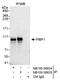 Progesterone-induced-blocking factor 1 antibody, NB100-58834, Novus Biologicals, Western Blot image 