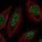 Protein SSXT antibody, NBP2-31777, Novus Biologicals, Immunocytochemistry image 
