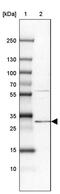 Phosphatidylinositol N-acetylglucosaminyltransferase subunit C antibody, PA5-57757, Invitrogen Antibodies, Western Blot image 