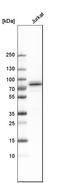 Thymocyte Selection Associated antibody, HPA031425, Atlas Antibodies, Western Blot image 
