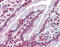 ATP Binding Cassette Subfamily C Member 8 antibody, ARP43622_P050, Aviva Systems Biology, Immunohistochemistry paraffin image 