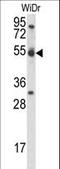 Cyclin I antibody, LS-C168477, Lifespan Biosciences, Western Blot image 