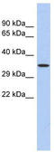 PR/SET Domain 12 antibody, TA331788, Origene, Western Blot image 