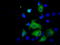 Sterol O-acyltransferase 2 antibody, TA501217, Origene, Immunofluorescence image 