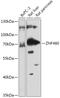Zinc Finger Protein 460 antibody, 18-011, ProSci, Western Blot image 