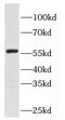 Eyes absent homolog 2 antibody, FNab02914, FineTest, Western Blot image 